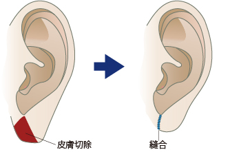 「耳の下半分」（耳垂／じすい）が大きい