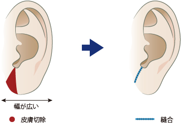 横方向に縮める