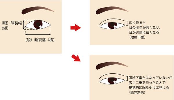 「元々目ヂカラが強くないところへ広めの二重を造ってしまった」について