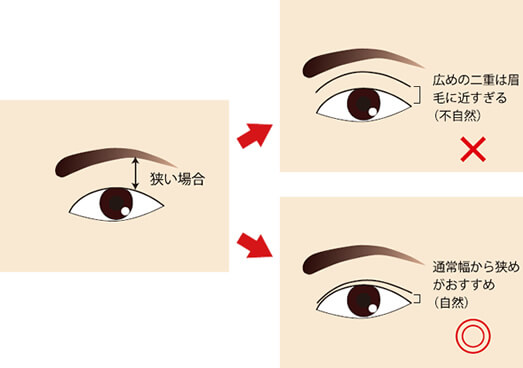 二重ラインが眉毛に近すぎる