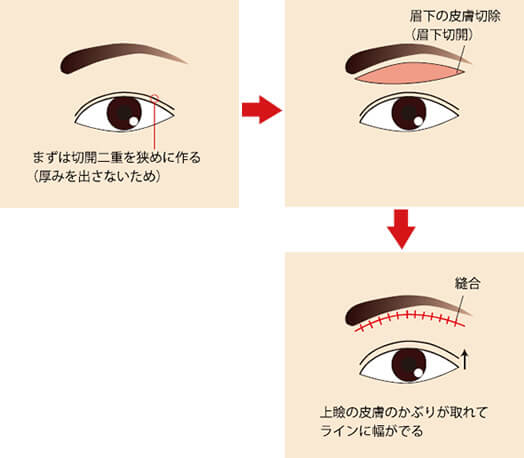 「眉下の傷跡が目立つ」について