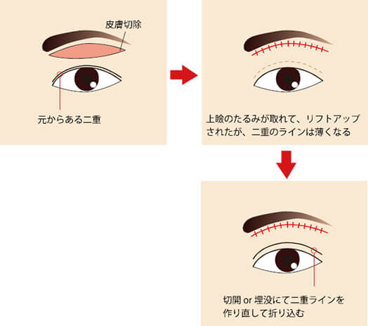 「二重の折り込みが浅くなってしまう」について