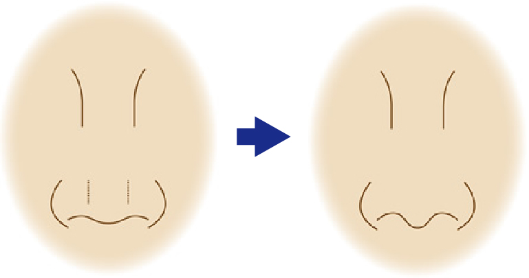平坦な鼻の穴のフチにメリハリをつける