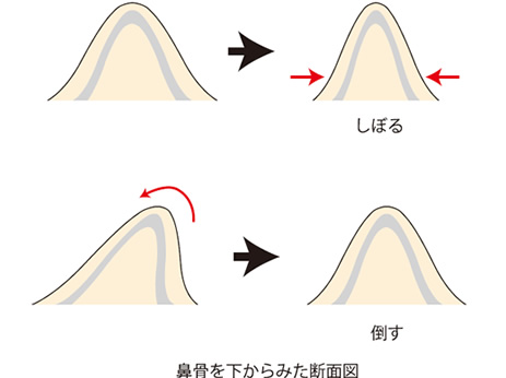 鼻骨を下からみた断面図