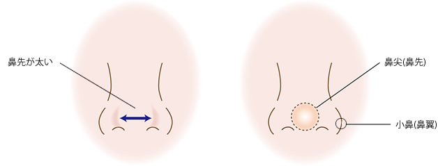 鼻先（鼻尖）と小鼻（鼻翼）の違い