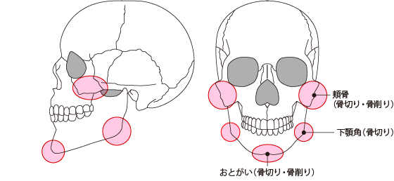 小顔整形「輪郭3点」でアプローチする部位