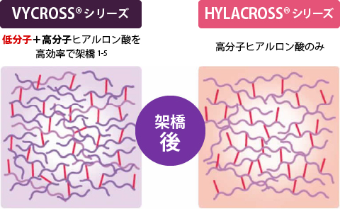 アラガン社独自の特許技術「*VYCROSSバイクロス」について