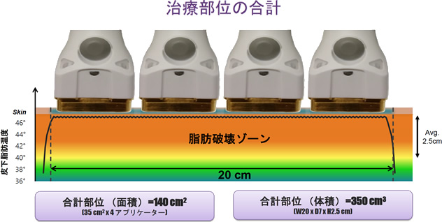 治療部位の合計