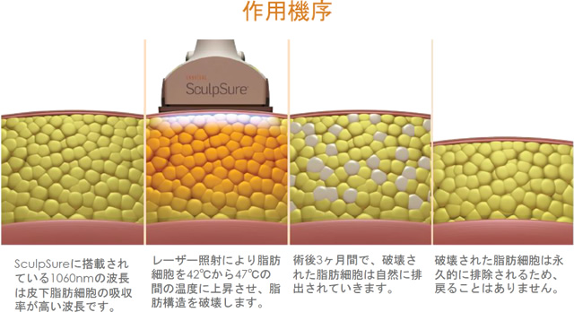 作用機序