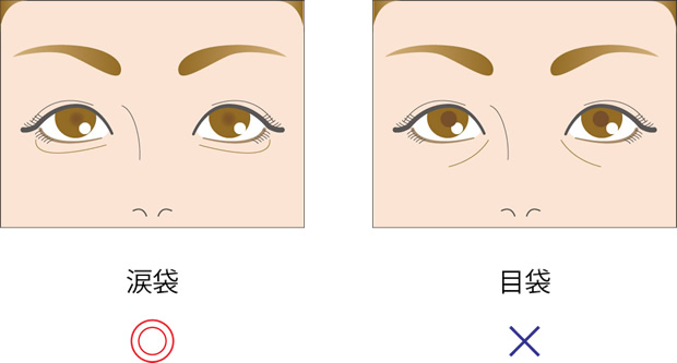 涙袋と目袋の違い